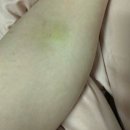야구랑 일상 둘 다 포기 못 하는 25년 2월