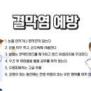 우성콘택트렌즈 이미지