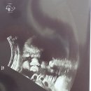 레츠모터스 | [37주 임신일기] 출산 전 마지막 검진, 산후도우미 경비 신청, 유축기 대여, 신생아 세차, 임산부 왁싱