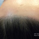 킴스헤어라인 이미지