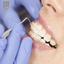 킴스미의원 | 동탄치아교정 부정교합 교정 치료