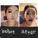 관리 끝판왕 청주피부관리 약손명가