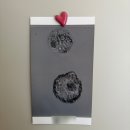 서울오한의원 | 서울아이앤여성의원 통배 동결이식 감자배아 면역글로불린 박찬우원장님 준비물 꿀팁