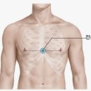 정신신경과 진료, 치료도 도움이 될 수 있습니다. 이미지