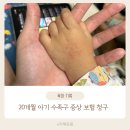 청구어린이집 | 20개월 아기 수족구 증상 입원 생활 보험 청구