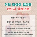 발관리 이미지