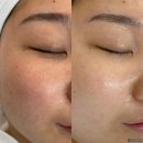 러브썸뷰티 - 남구 | 의정부 피부관리, 여기가 찐이었어요! 러브썸뷰티샵 솔직 후기