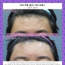 하나로피부과의원 네이버블로그