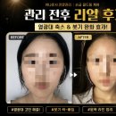 상동로 | 부천 경락ㅣ사운드바디 사운드스킨 부천점ㅣ예비신부 솔직후기
