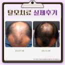 레이크봄봄피부과의원 | 안산탈모병원｜M자·정수리 고민, 탈모치료 상담에서 가장 공감되는 질문