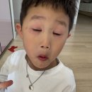 순천향소아과의원 네이버블로그