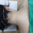 은평본정형외과의원 | 은평구 정형외과 #은평본정형외과의원
