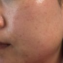 GS홈쇼핑에서 파는 식물성 엑소좀 50 앰플 진짜 좋을까?