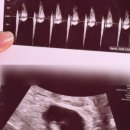 르샘여성의원 이미지