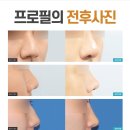 프로필성형외과의원 이미지
