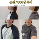 신사주유소 - 청원군 | 신사역피부과 슈링크 리프팅레이저300샷 통증과 효과 솔직후기