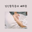 장야2 | 임신중독증, 출산 후에도 안심? 폐부종으로 고생했던 출산 이야기