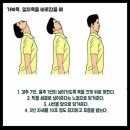 바른척추 이미지