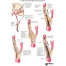 정통추나 수기치료 - 돌연사와 심장마비(Heart Stroke) 이미지