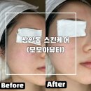 상암 스킨케어 모모아뷰티 카복시테라피 후기 브라질리언 왁싱 잘하는곳