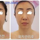 김언니피부샵