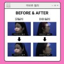 아비쥬의원부평 이미지