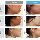 나라치과의원 이미지