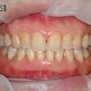 모치과기공소 이미지