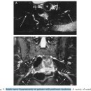 MR neurography라는 MRI진단에 대한 논문, MRI의 진화 이미지