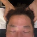 가윤이네리본 | 구로 피부관리 추천 가윤에스테틱 후기