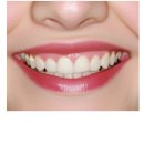 365아홉가지약속치과병원 | 아산치과 15년의 경력으로 실력을 갖춘 365아홉가지약속치과병원