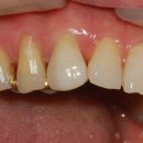 백상치과기공소 이미지