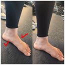 브이아이핏 이미지