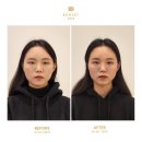 보나트페이스 네이버블로그