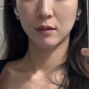 이수병원 | 이수역 피부과 안 아픈 티타늄리프팅 키닥터 후기:)