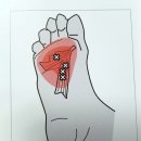 경희하늘한의원 네이버블로그