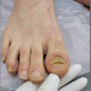하이풋 | 김천발관리 하이풋 본점 내돈내산 찐 후기