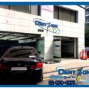 덴트존 이미지
