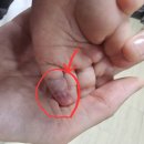 구미순천향병원 | 구미 순천향병원 응급실 후기, 아기 손가락 골절 진료비 1,800원?