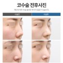 리미트성형외과의원 이미지