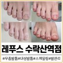 수락산역 4~5번출구 | 노원 무좀발톱 더 이상 감추지 마세요 만족도 100% 레푸스 수락산역