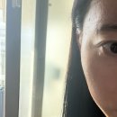 마포지금약국 | 편평사마귀 제거 솔직 후기｜시술 과정·통증·주의사항까지 정리!