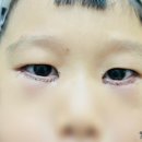 연세우리안과의원 이미지