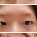 둔산DS피부과 이미지