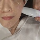 프라임 | 압구정 울쎄라 윤곽까지 달라진 리프팅의 진심 울쎄라피 프라임 후기