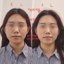 종로피부화장품 | 종로 광화문 피부관리 어예건 페이스PT 솔직후기