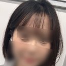 눈밑지 후기 (2) 병원 발품을 팔아보자 근데 귀찮은..