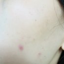 벌교맑은의원 이미지