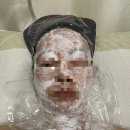 이삭약국 | 부평 편평사마귀 성지 이삭가정의학과 / 여름 사마귀 제거 후기