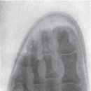 현대신발 이미지